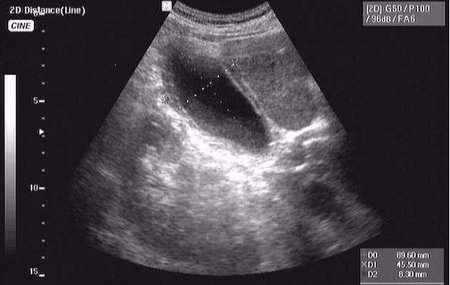 Онищук76 11.JPG