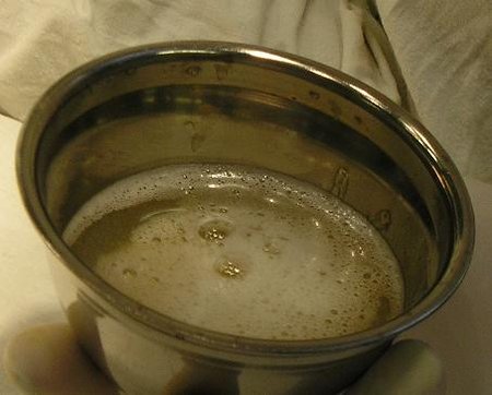 вот что получили. Амилаза - 300.