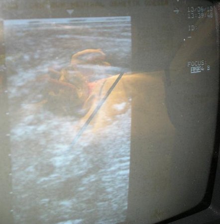 а вот так - узисты (состояние "во время")