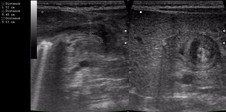 сорри, колесико недотянула