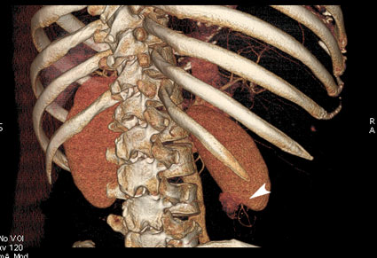 3D-реконструкция