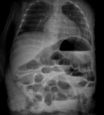 Рентген ОБП.jpg