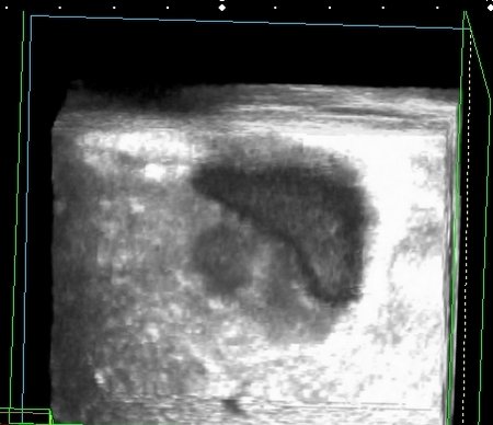 3D - реконструкция