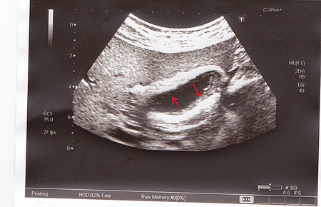 вот непонятно,что это и к чему относится. слизистая такая может быть?