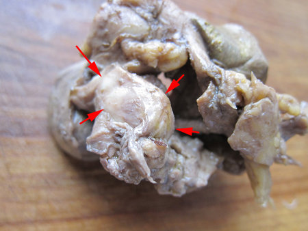 Фиксированный макропрепарат ЖП. Опухоль обозначена стрелками.