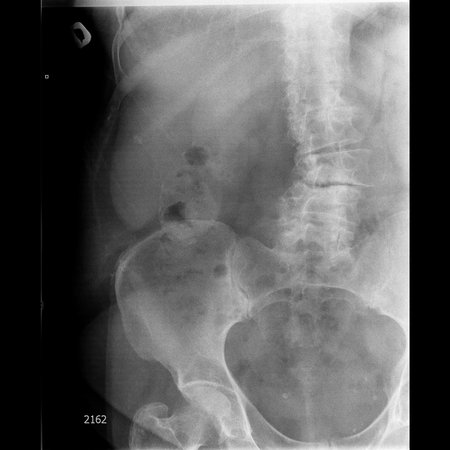 Pilvas-SKRANDIS GULINT ANT PILVO-2014.03.31-10_36_56-562.JPEG