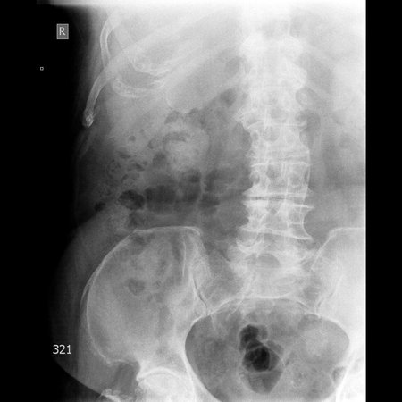 Pilvas-UROGRAMA AP-2014.04.18-09_10_09-687.JPEG