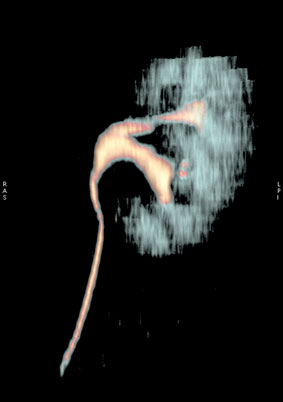 3D-реконструкция