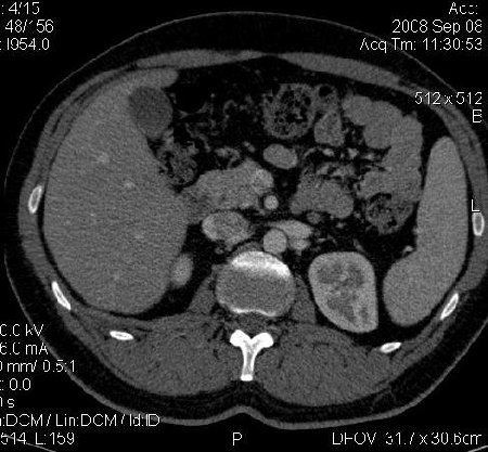 Horseshoe art.0001.jpg