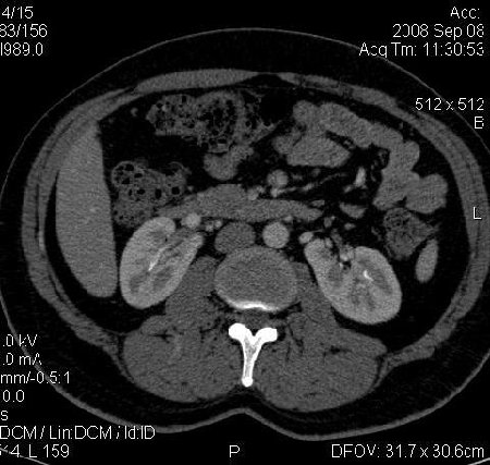 Horseshoe art.0002.jpg