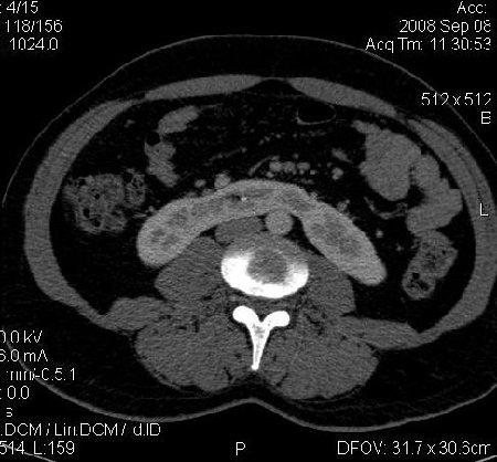 Horseshoe art.0004.jpg