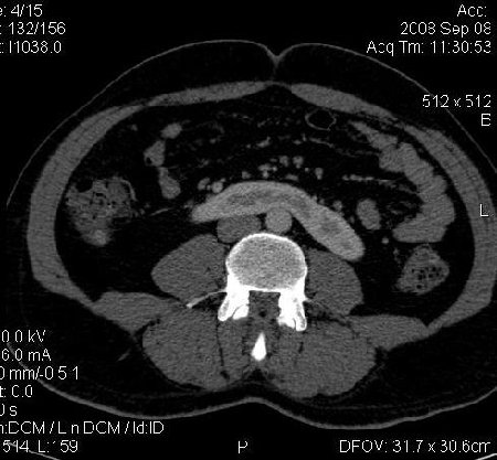 Horseshoe art.0005.jpg