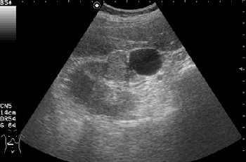 Поперечное серошкальное сканирование.