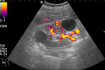 Сканирование в режиме энергетического доплера.