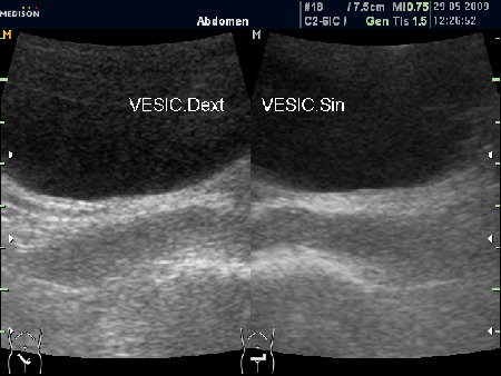 "Нормальные" СП (ТА УЗИ)