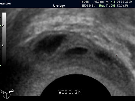 "Нормальные" СП (ТР УЗИ)