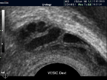 "Нормальные" СП (ТР УЗИ)