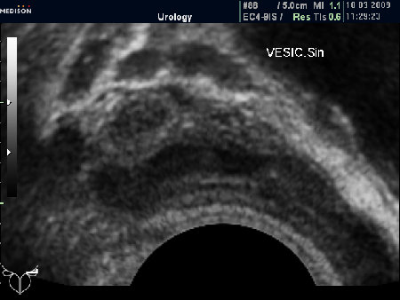 Застойные явления в СП