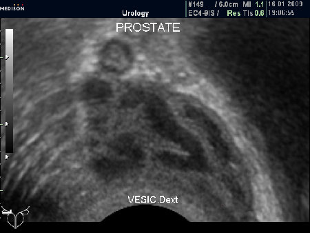 Застойные явления в СП